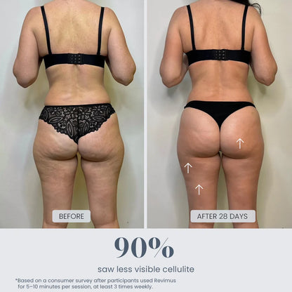 Lumera Cellulite Massager™